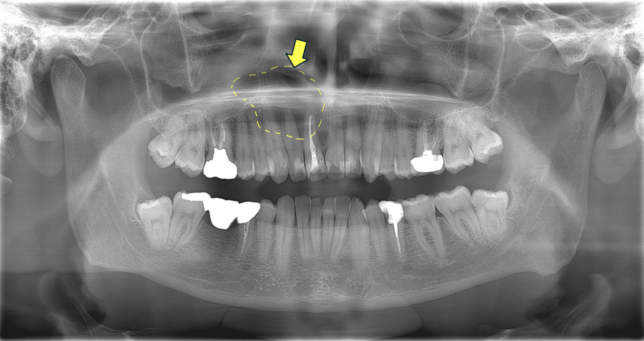 X線画像診断例1