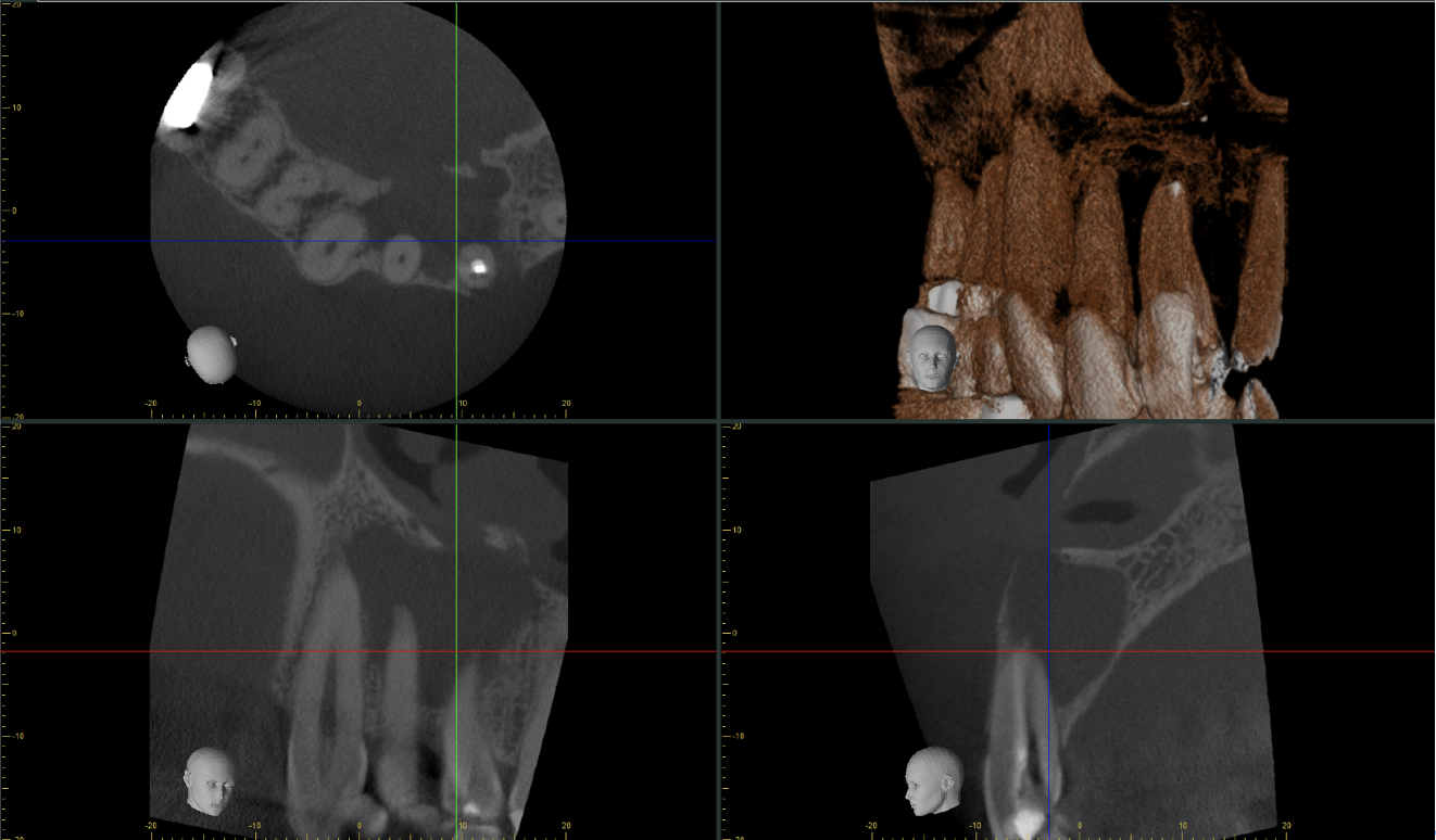 X線画像診断例2