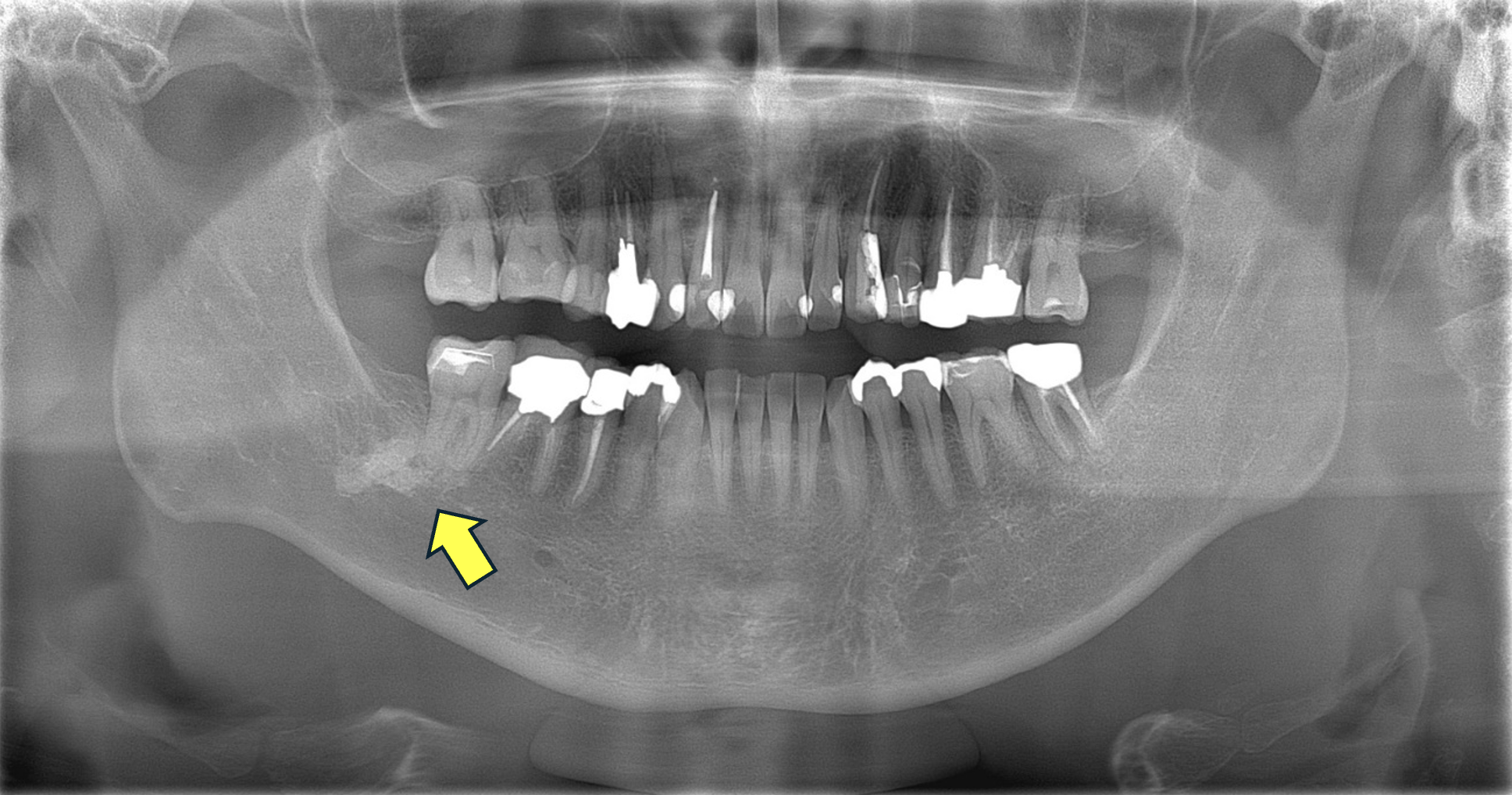 X線画像診断例2