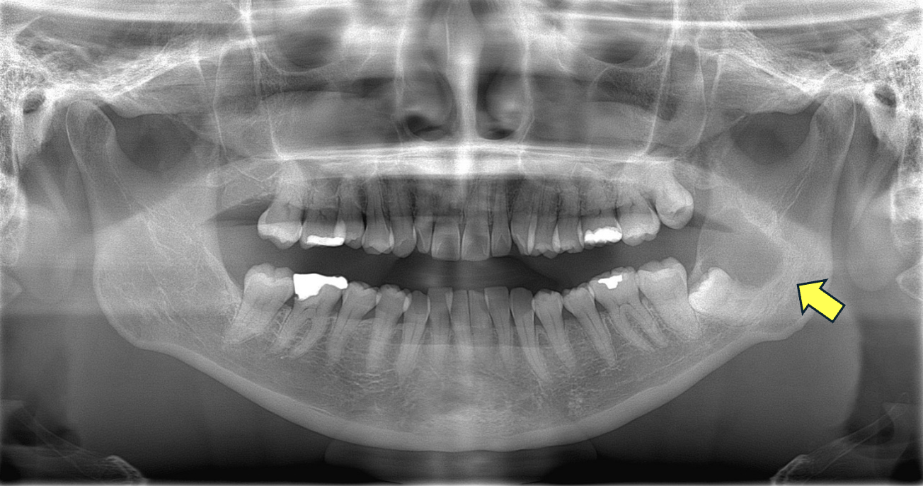 X線画像診断例2